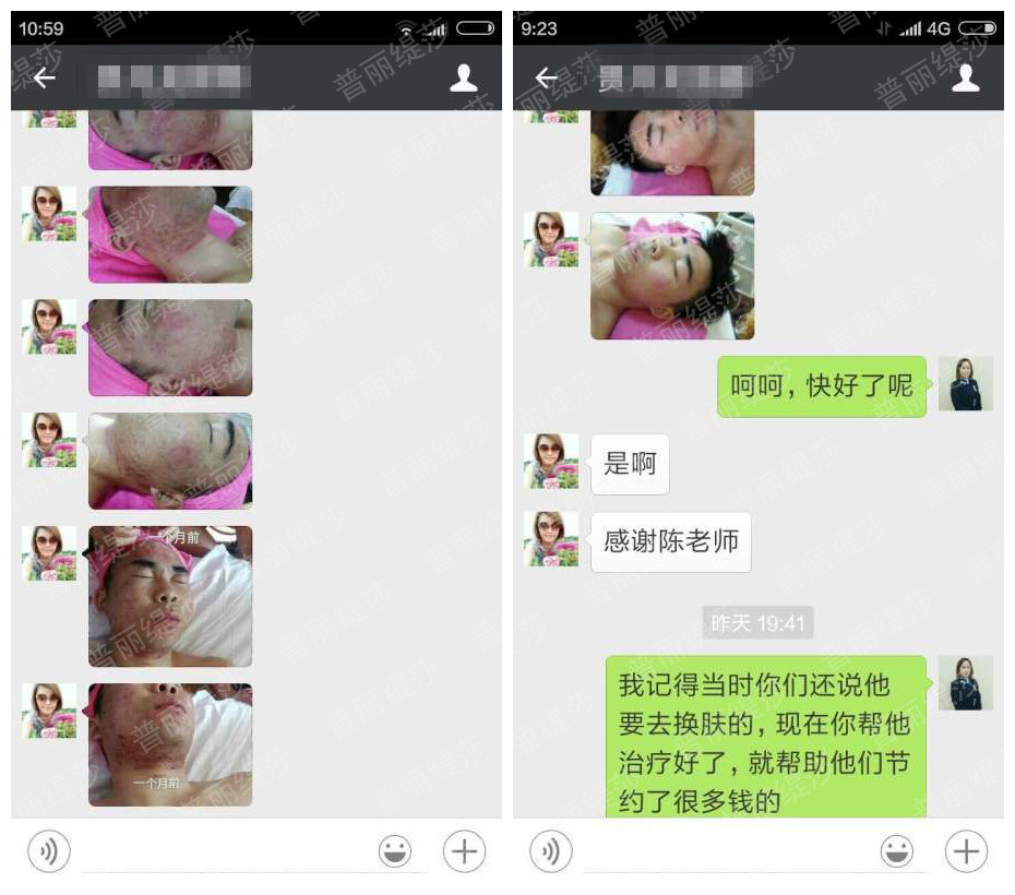 美容院祛痘神器：绿茶清爽系列造就祛痘奇迹